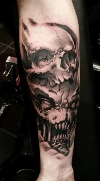 Nathan’s Forearm